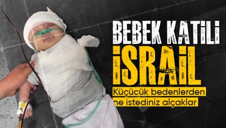 İsrail hücumlarında kolu kopan Gazzeli minik bebek